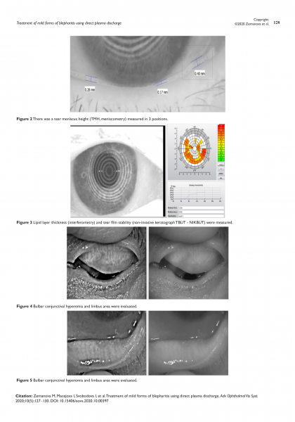 Treatment of mild forms of blepharitis using direct plasma discharge - M. Zemanová, I. Macejová, I. Svobodová, E. Vlková 2.png