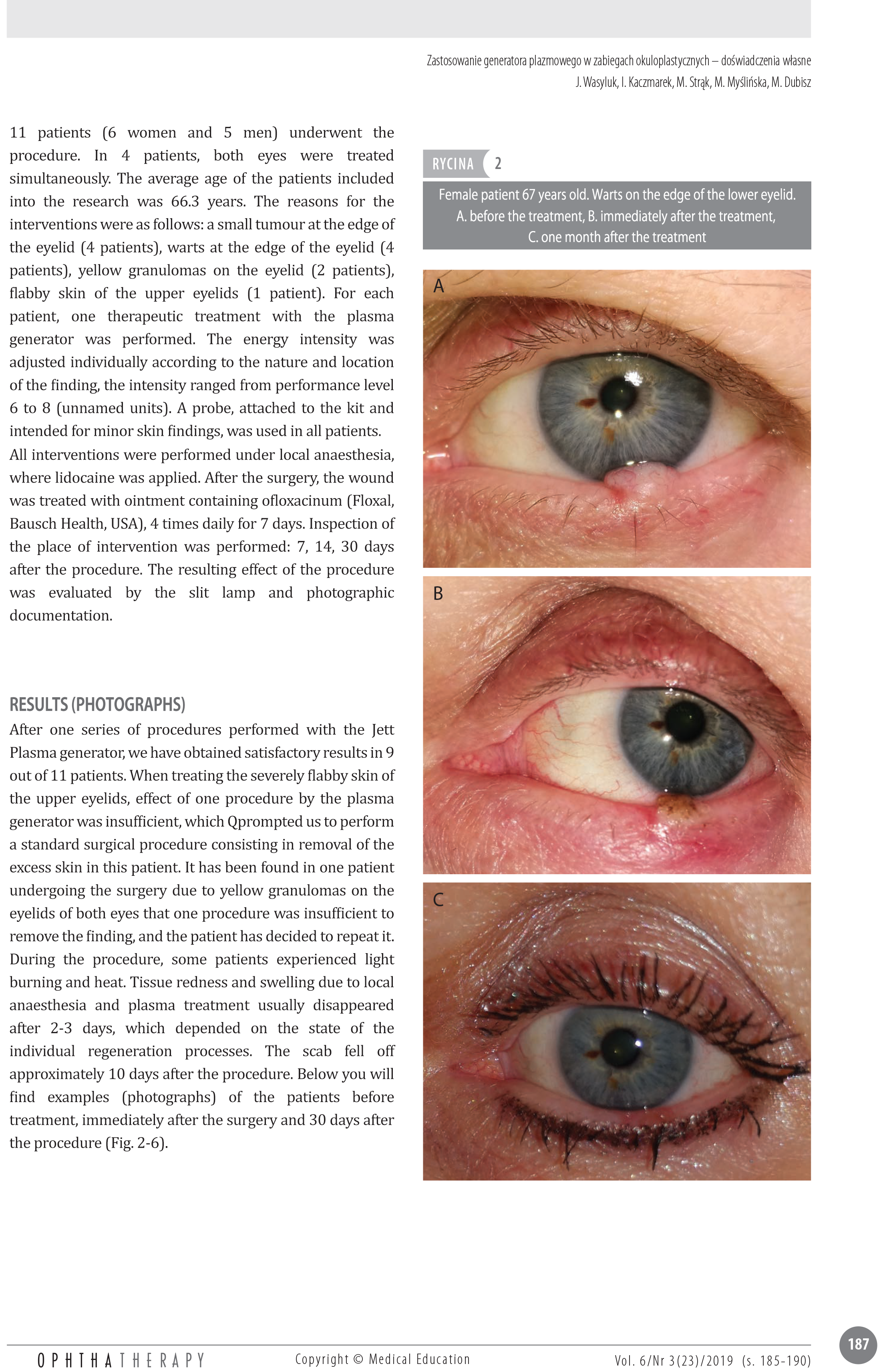 Boli ale vederii și ale ochilor